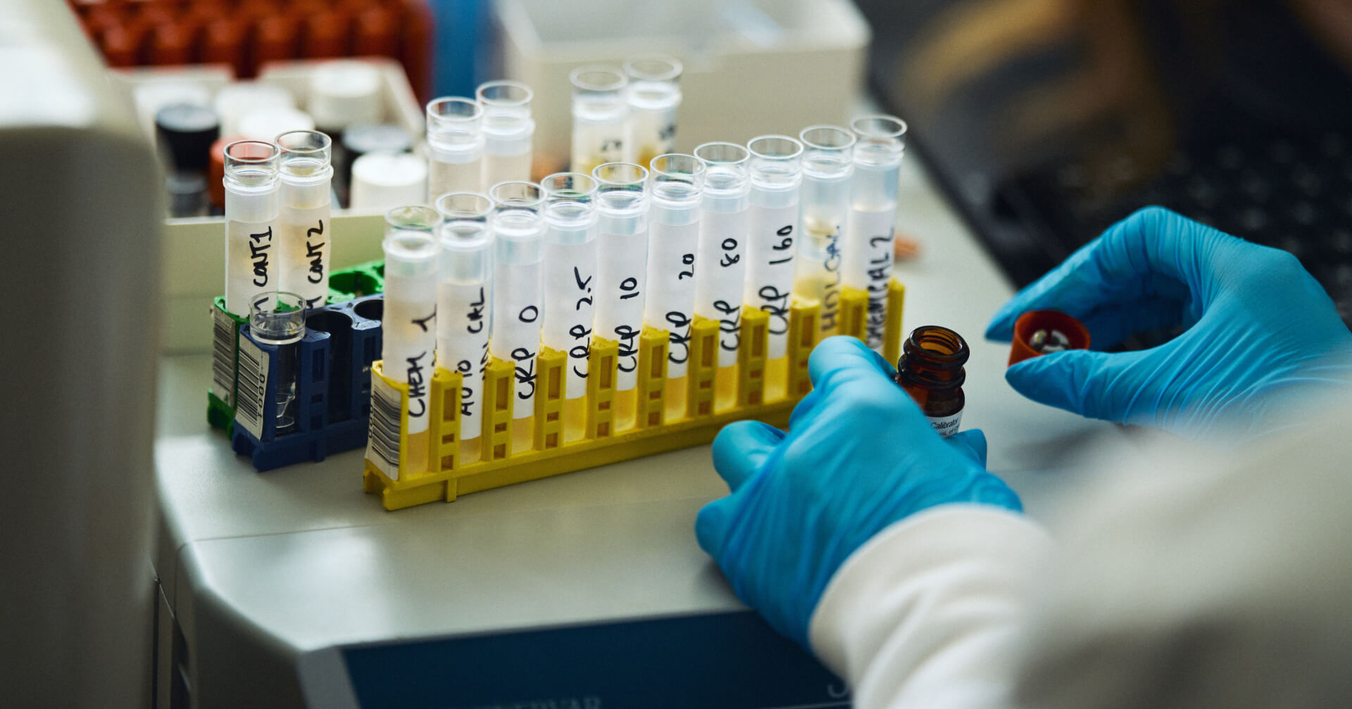 Hims & Hers acquires at-home lab testing facility, expanding capabilities to ultimately include affordable whole body testing for subscribers