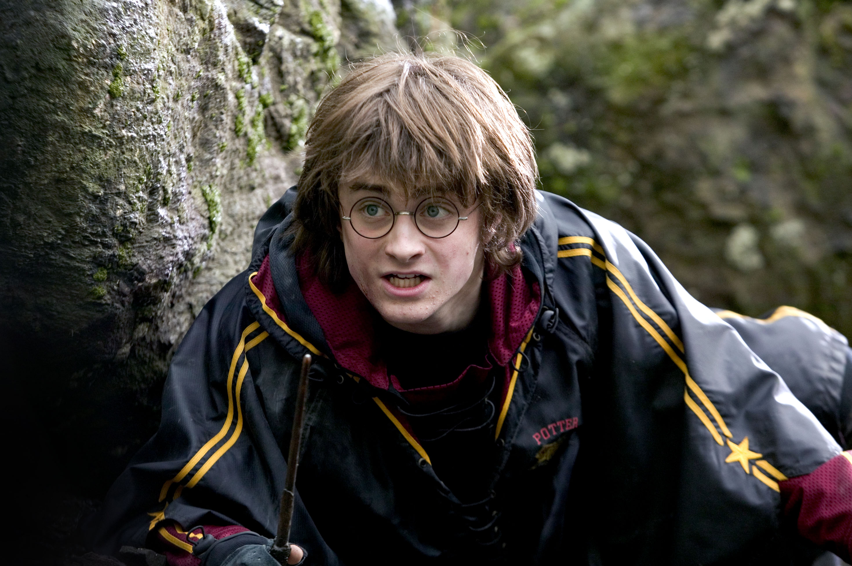 _Harry before SmileDirectClub_